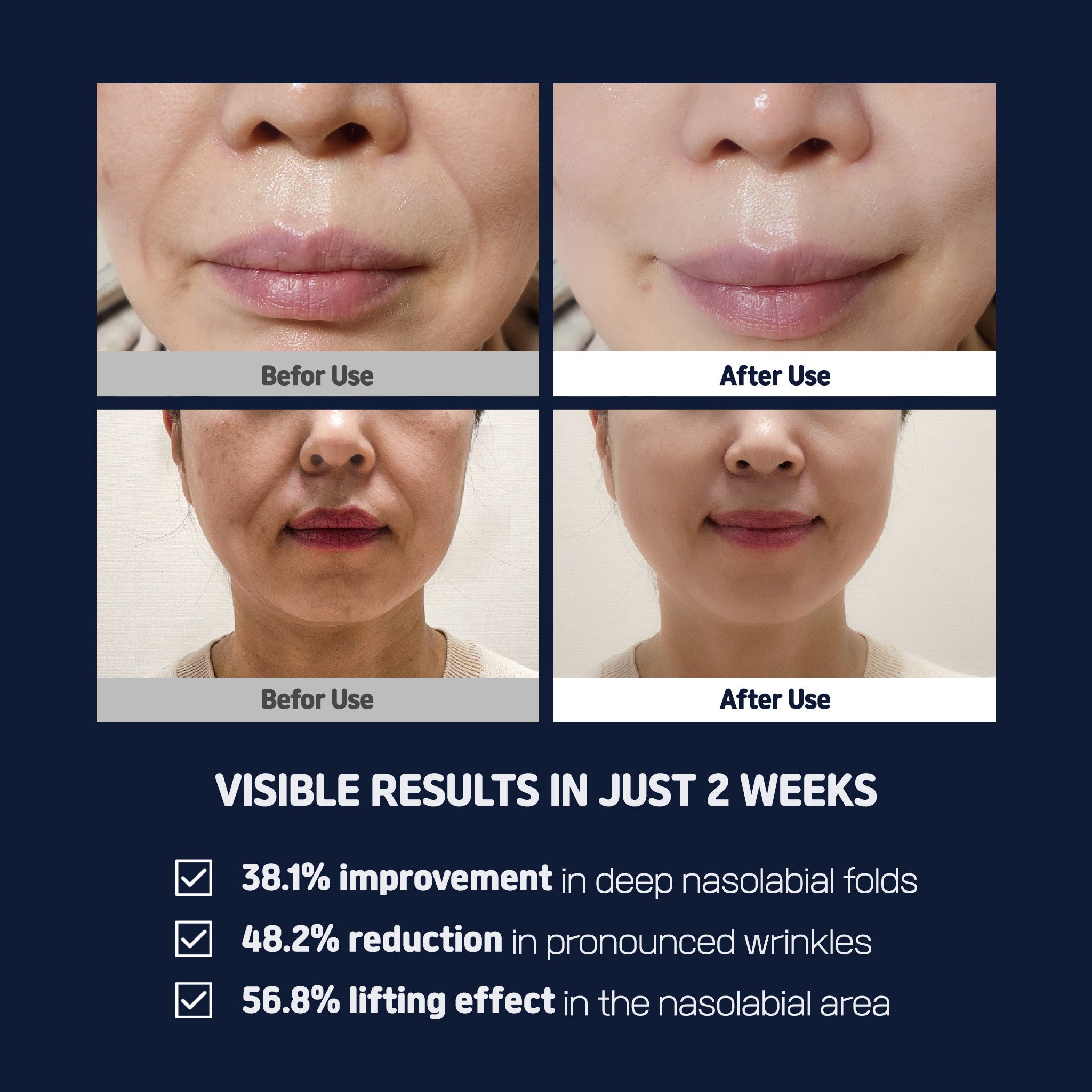 PLLA Age Reset Wrinkle Cream